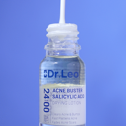 Salicylic Acid Acne Treatment Drying Lotion