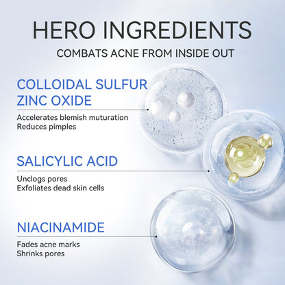 Salicylic Acid Acne Treatment Drying Lotion