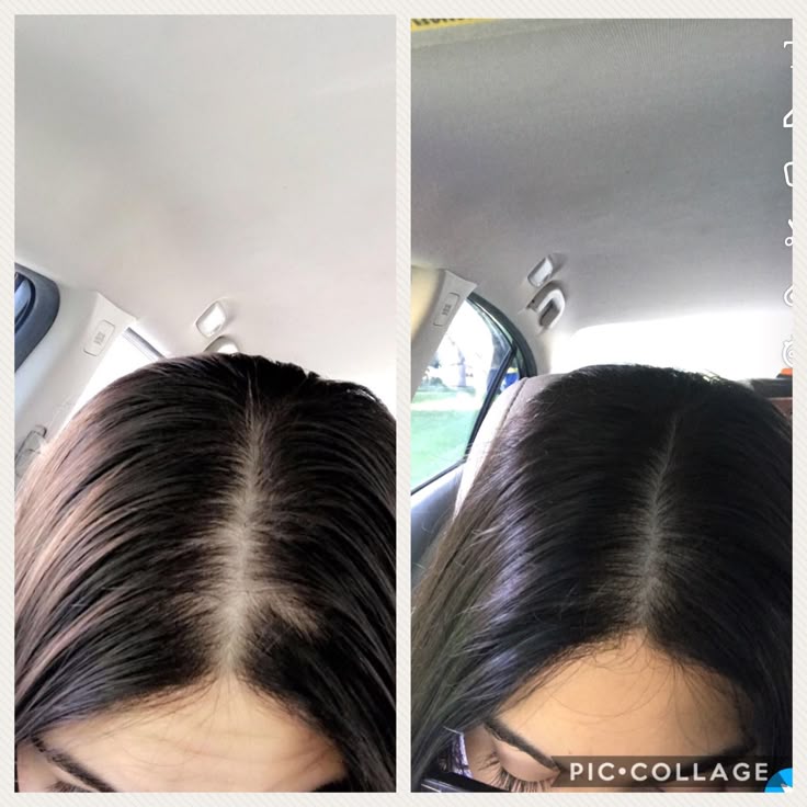 Scalpy Hair Growth Serum