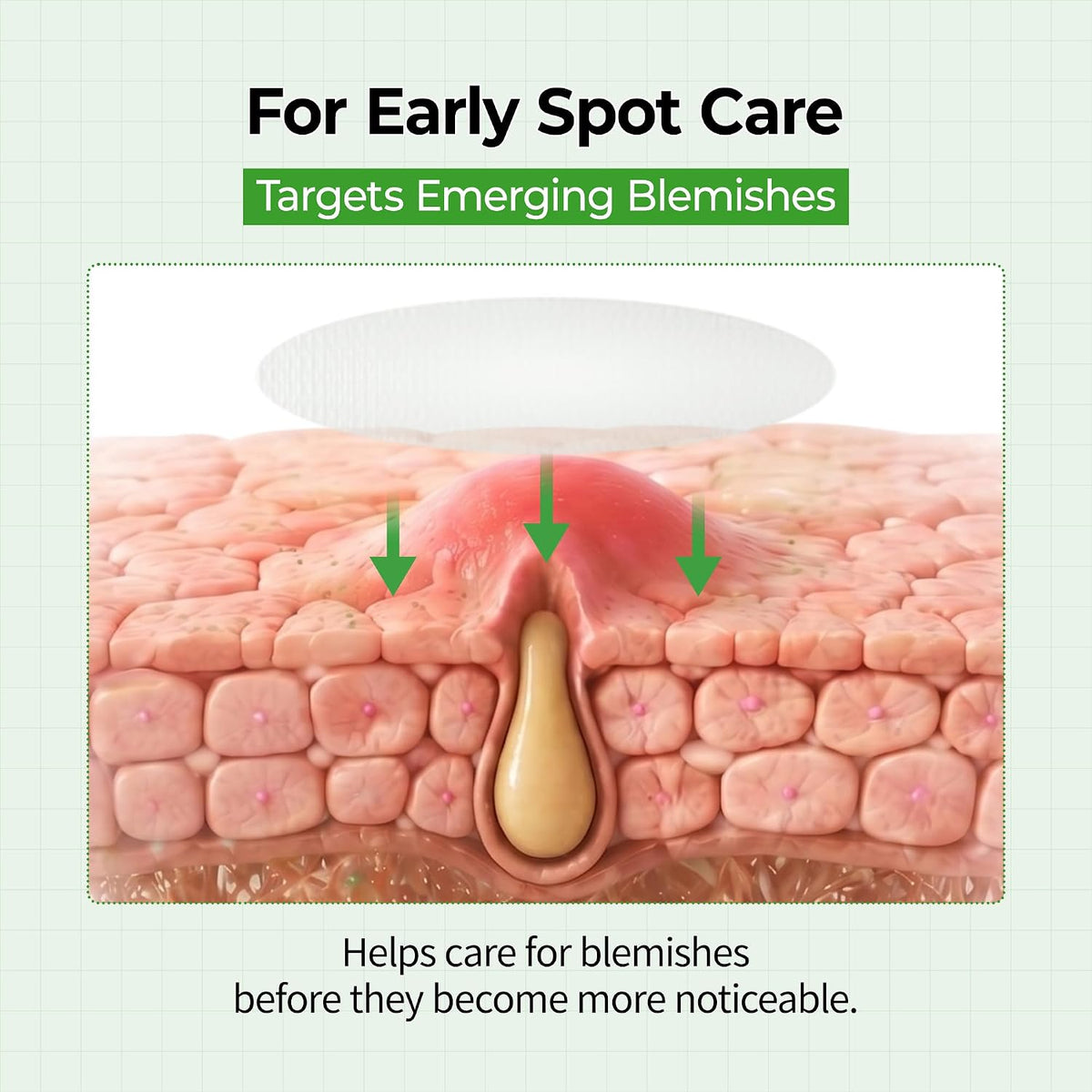 S-Zinc Zero-Fit Ultra Thin Blemish Spot Patch