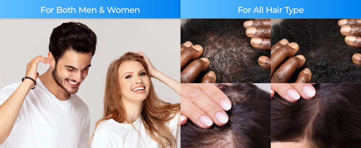 Scalpy Hair Growth Serum