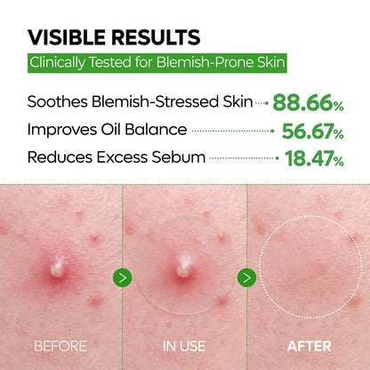 S-Zinc Zero-Fit Ultra Thin Blemish Spot Patch