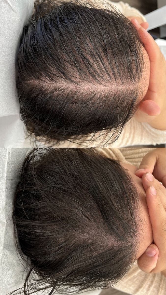 Scalpy Hair Growth Serum