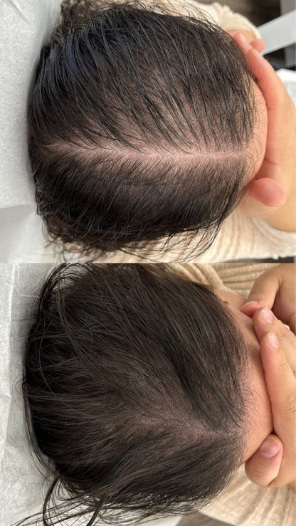 Scalpy Hair Growth Serum