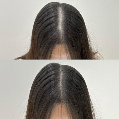 Scalpy Hair Growth Serum