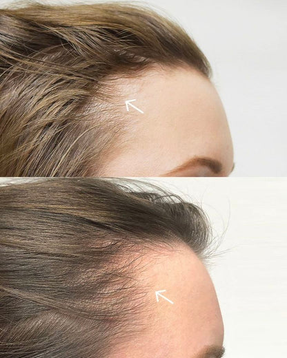 Scalpy Hair Growth Serum