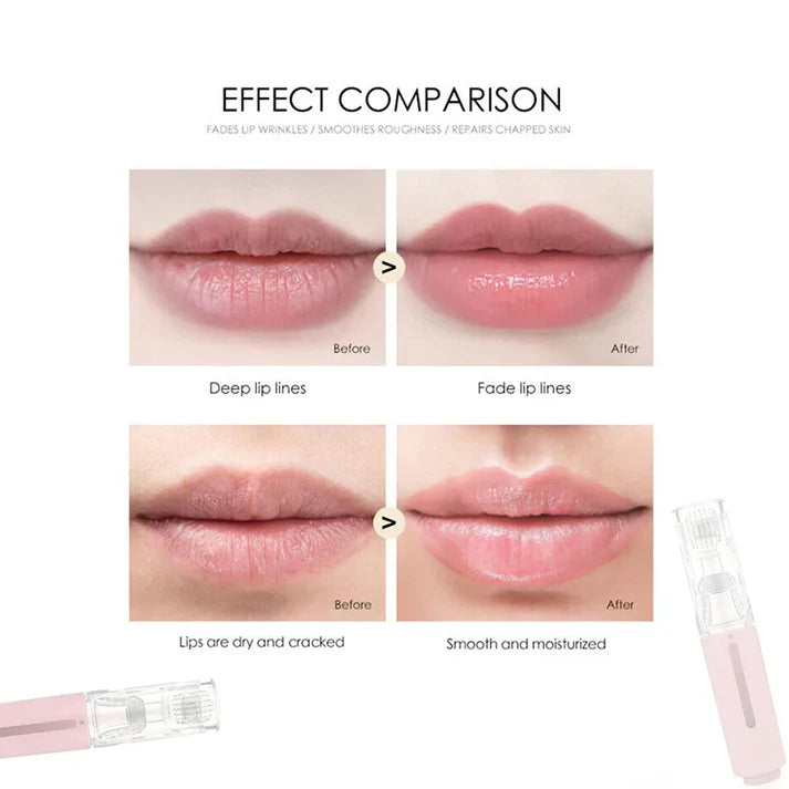 Lip Roller Kit with Plumping Serum